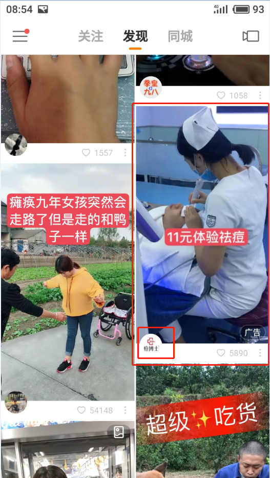 快手广告